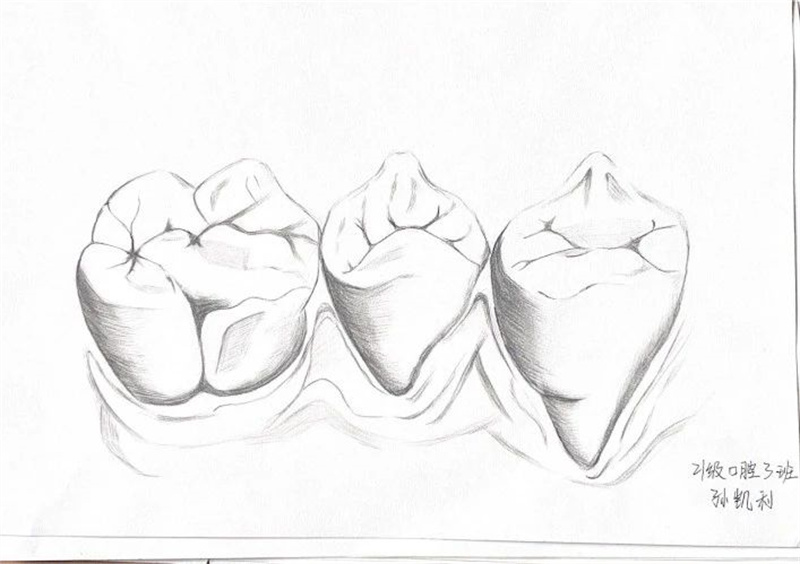 【医学技术系】米兰医学技术系举办口腔牙体形态素描大赛